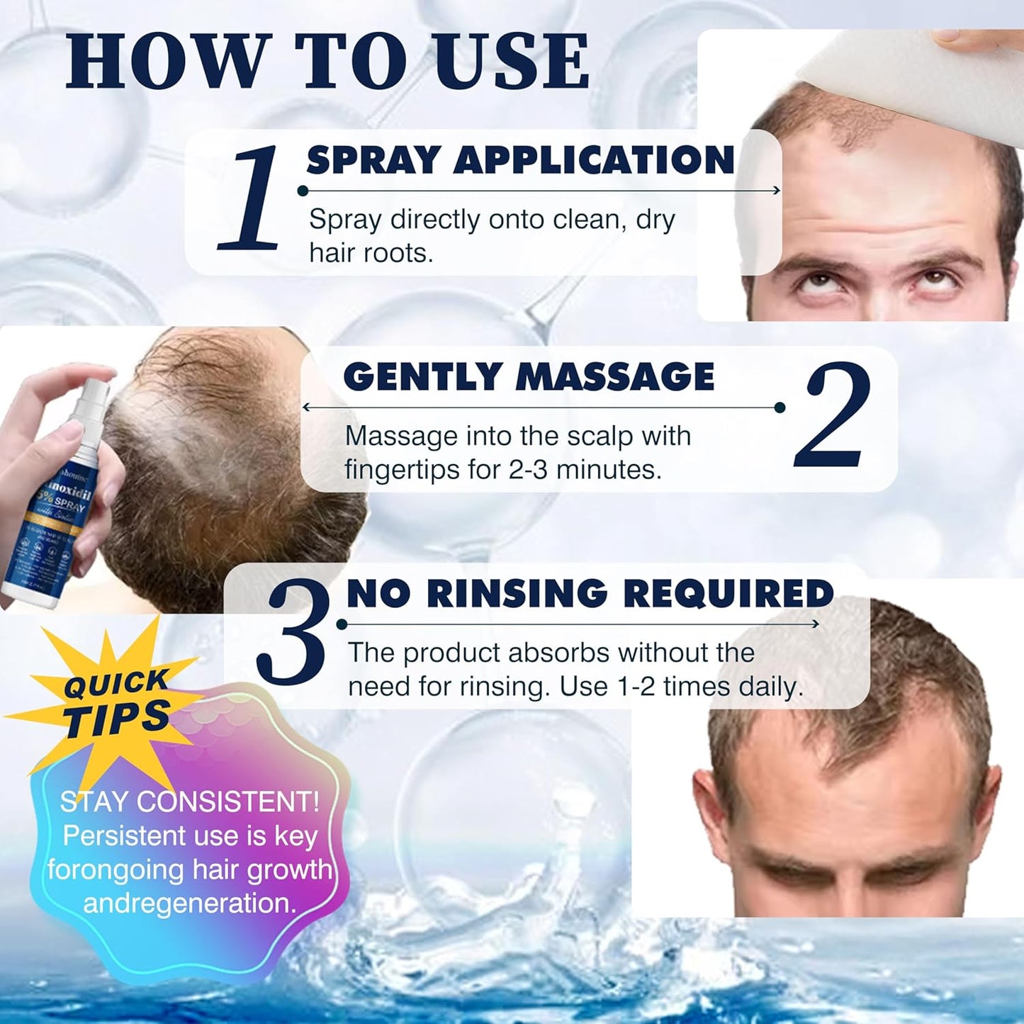 5% Minoxidil Hair Growth Spray Serum, Hair Regrowth Treatment for Men and Women, Strengthens and Thickens Hair for Fuller, Longer Results, Beard and Facial Hair Enhancer